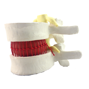 ENOVO颐诺医学人体腰椎间盘突出演示模型 脊神经模型骨科脊柱椎间盘膨出中医推拿按摩马尾神经压迫疼痛教具