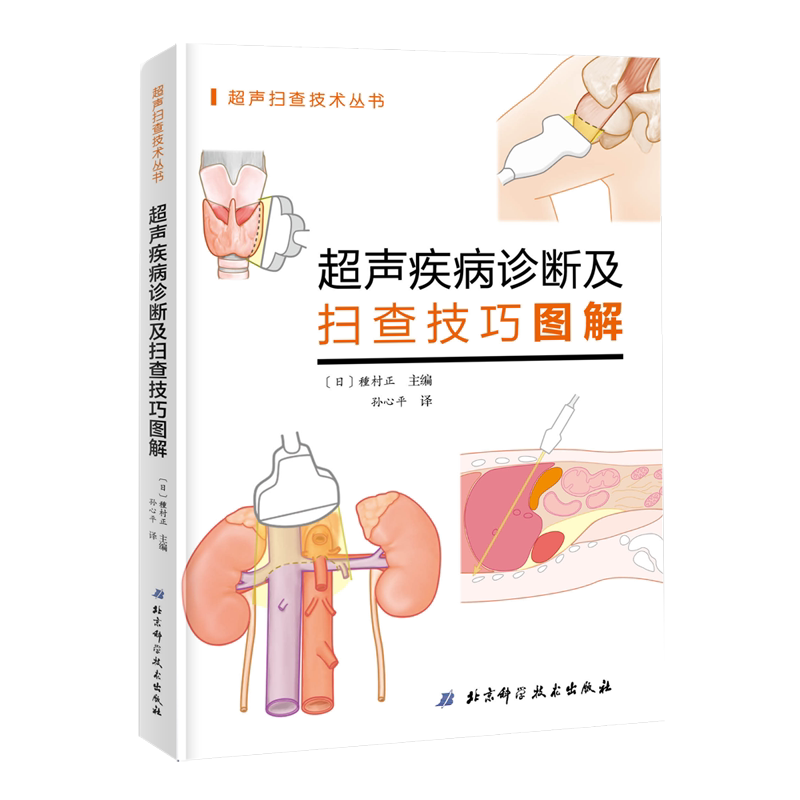 超声疾病诊断及扫查技巧图解 解剖学医学影像人体断层书籍正常值测量备忘录技术入门b超血管肌骨心超笔记腹部精细讲解心脏图谱扫描
