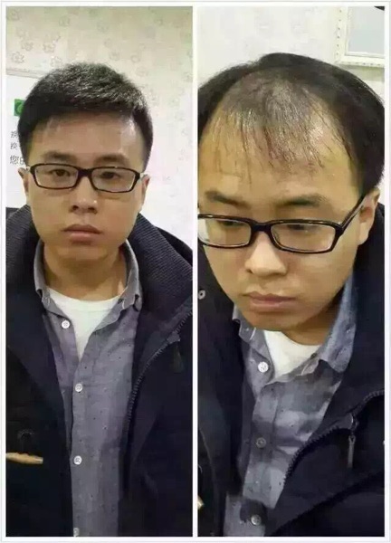 Extension cheveux - Ref 223946 Image 1