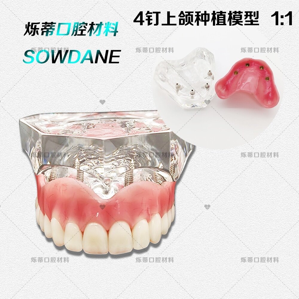 牙科种植模型4钉上颌齿科