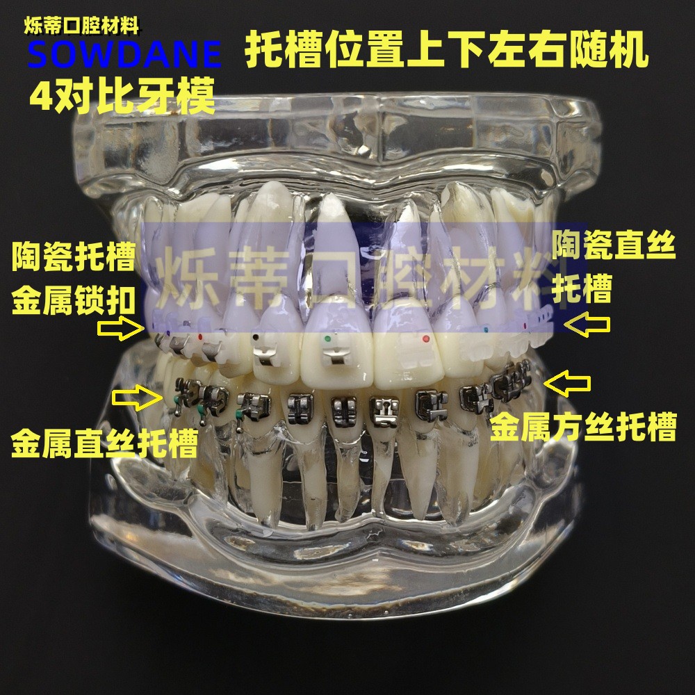 牙科牙模型4对比教学沟通
