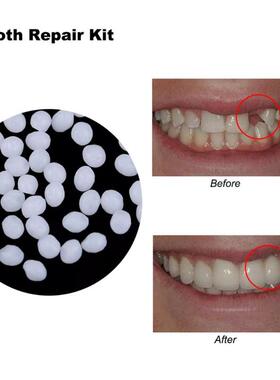 Gap Denture Adhesive Tooth-Repair-Kit Solid-Glue Dental-Rest