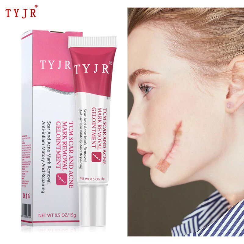 Remove scar Acn