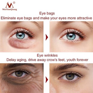 Eye Cream Anti-Puffiness Remove Wrinkles dark眼部走珠精华液