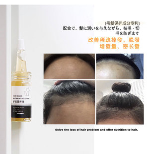 秃头小宝贝看过来！美小狐护发营养液稀疏发际线会浓密生长发仿脱