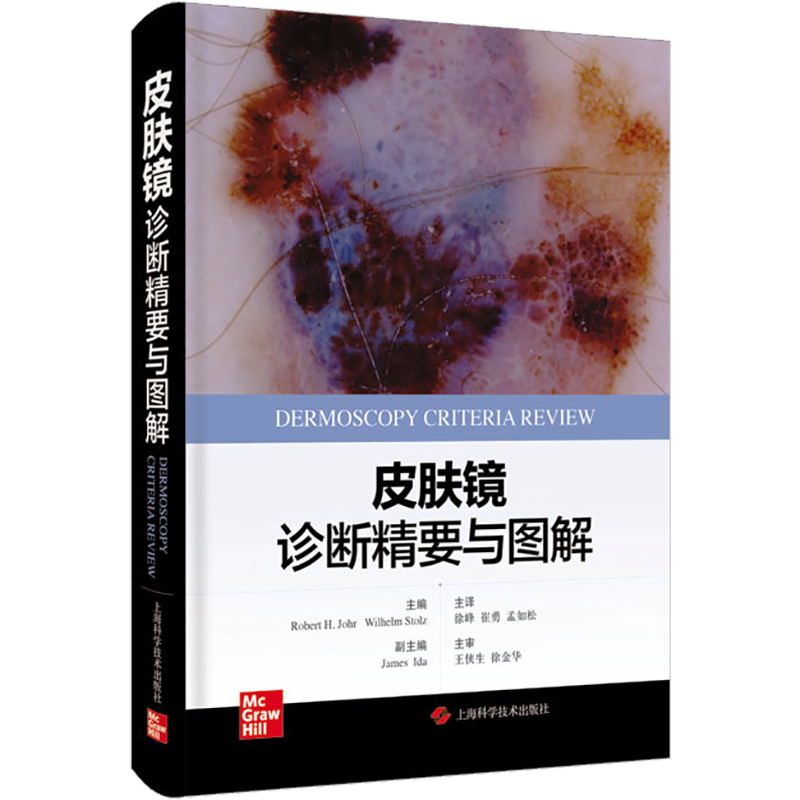 皮肤镜诊断精要与图解 正版书籍 皮肤科医学书皮肤镜诊断图谱皮肤镜标准综述皮肤病理学医学书籍 上海科学技术出版社9787547860823