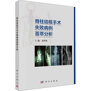 【新华文轩】脊柱结核手术失败病例荟萃分析 正版书籍 新华书店旗舰店文轩官网 科学出版社
