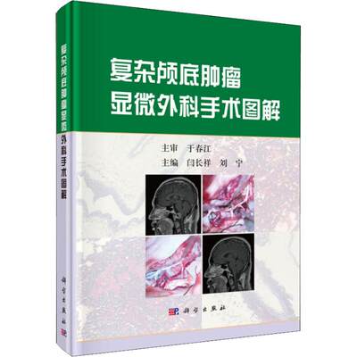 【新华文轩】复杂颅底肿瘤显微外科手术图解 正版书籍 新华书店旗舰店文轩官网 科学出版社