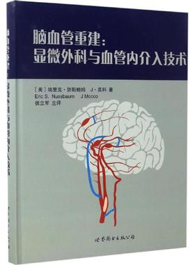 脑血管重建 (美)埃里克·努斯鲍姆(Eric S.Nussbaum),(美)J·莫科(J Mocco) 著;侯立军 译 正版书籍 新华书店旗舰店文轩官网
