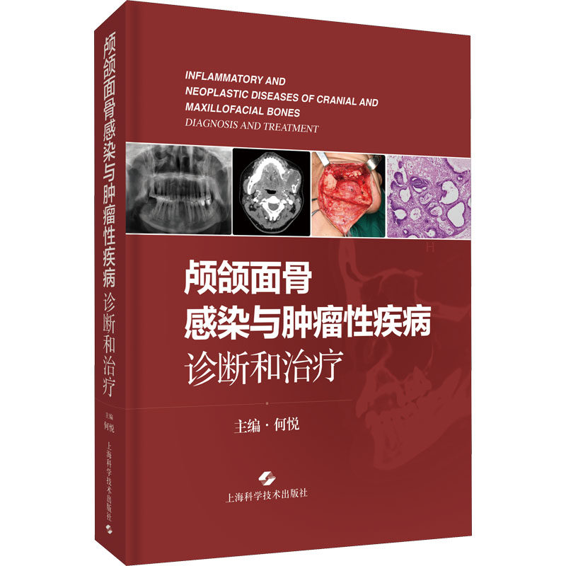 颅颌面骨感染与肿瘤性疾病:诊断和治疗 正版书籍 新华书店旗舰店文轩官网 上海科学技术出版社