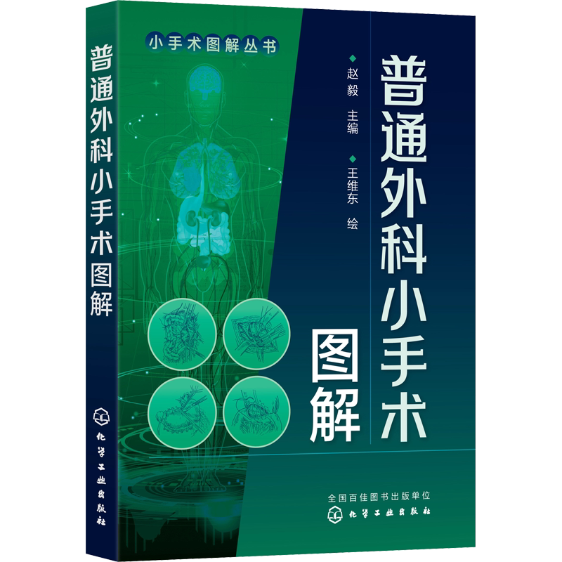 普通外科小手术图解 赵毅 编 外科基层普外科医生、大中型医院低年资住院医生。外科 化学工业出版社正版书籍