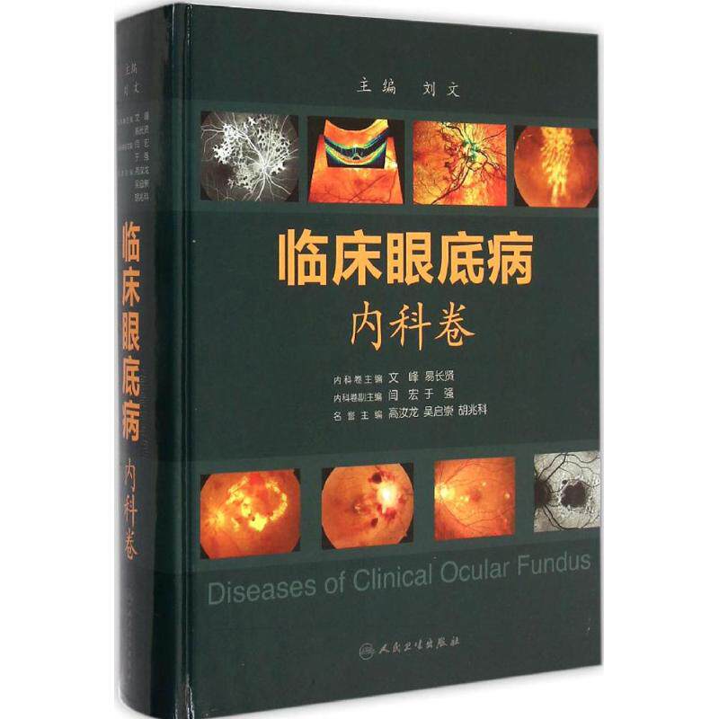 Clinical fundus disease Internal Medicine Volume Liu Wen Editor Legal books Xinhua Bookstore Flagship store Wenxuan Official website the people Health Pressin the Books/Magazine/Newspaper , Medical Health , Ophthalmology  category - from Buy2taobao.com to provide professional Taobao agent buy service