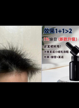 发量小富婆 炸毛精华 XVII17型胶原腺苷非那雄胺头皮精华清爽啫喱