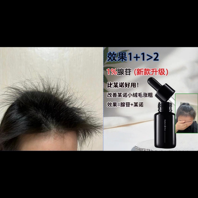 发量小富婆 炸毛精华 XVII17型胶原腺苷非那雄胺头皮精华清爽啫喱