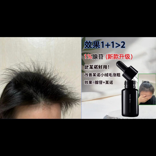 发量小富婆 炸毛精华 XVII17型胶原腺苷头皮精华清爽啫喱