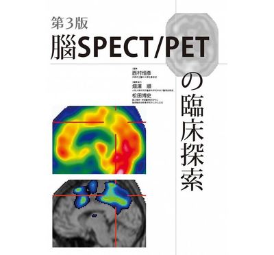 预售正版 西村恒彦脑SPECT/PETの临床探索(第3版)枫书坊16  医疗保健 原版进口书