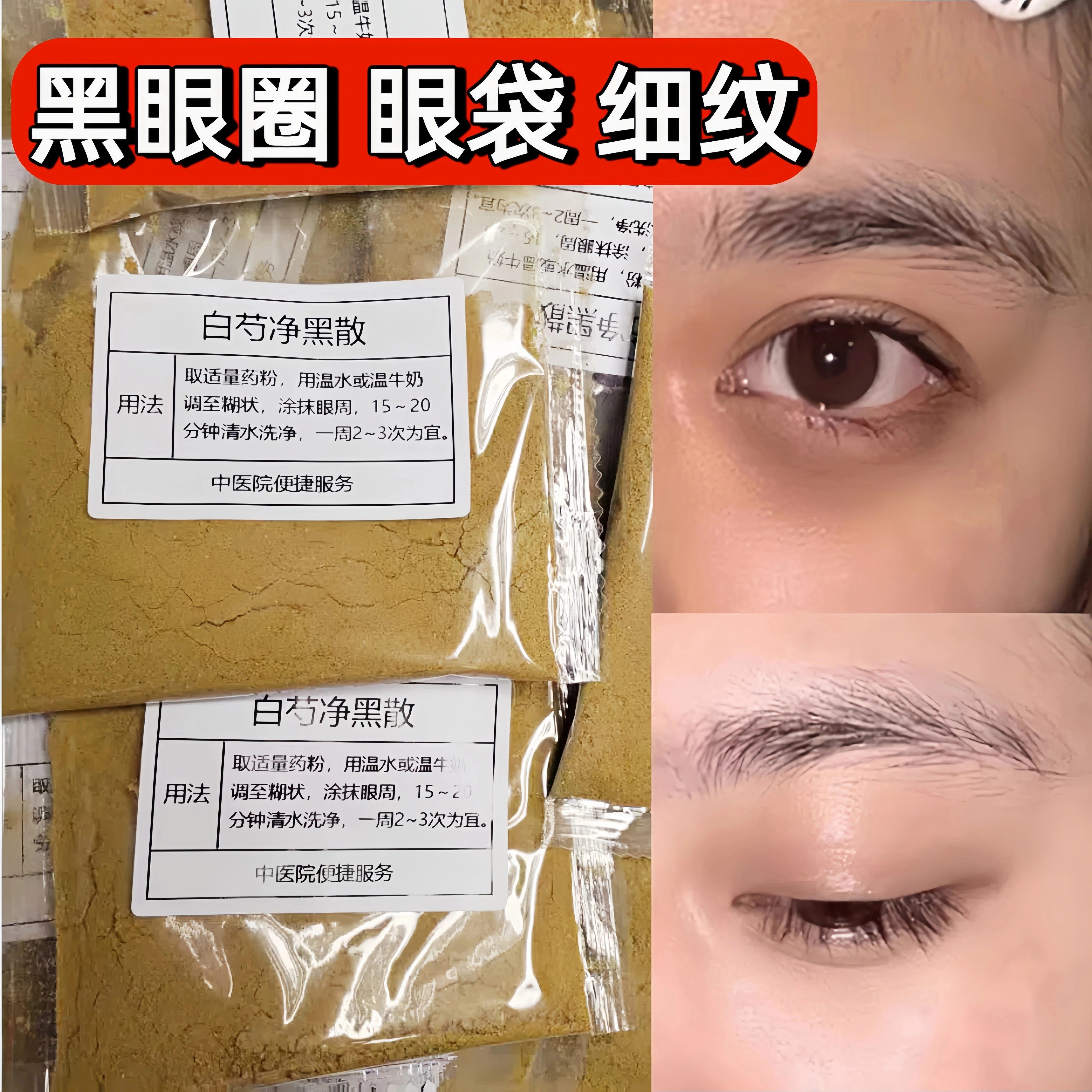 杭州中院【白芍净黑散】眼袋眼纹 黑眼圈 眼部细纹 面膜