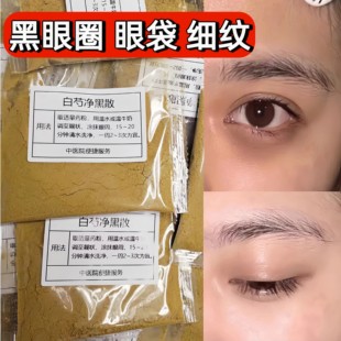 杭州中院【白芍净黑散】眼袋眼纹 黑眼圈 眼部细纹 面膜