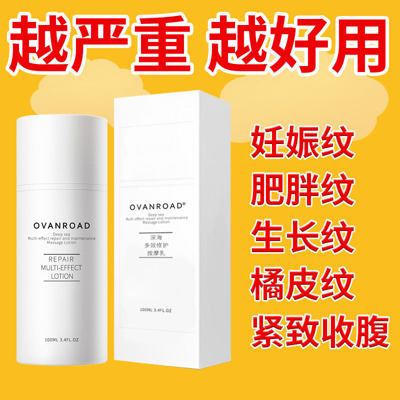 欧梵路妊娠修复霜孕妇专用神器橄榄油产后紧致预防祛肥胖纹用品