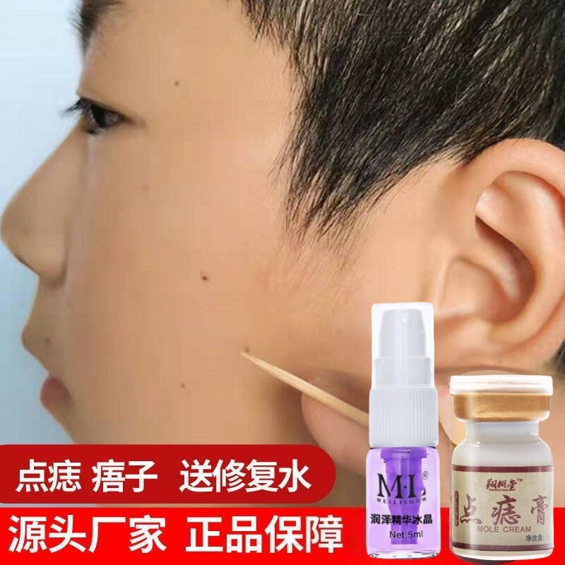 【植物古方】官方正品美容院同款脸部身体专用点痣膏修复液套装