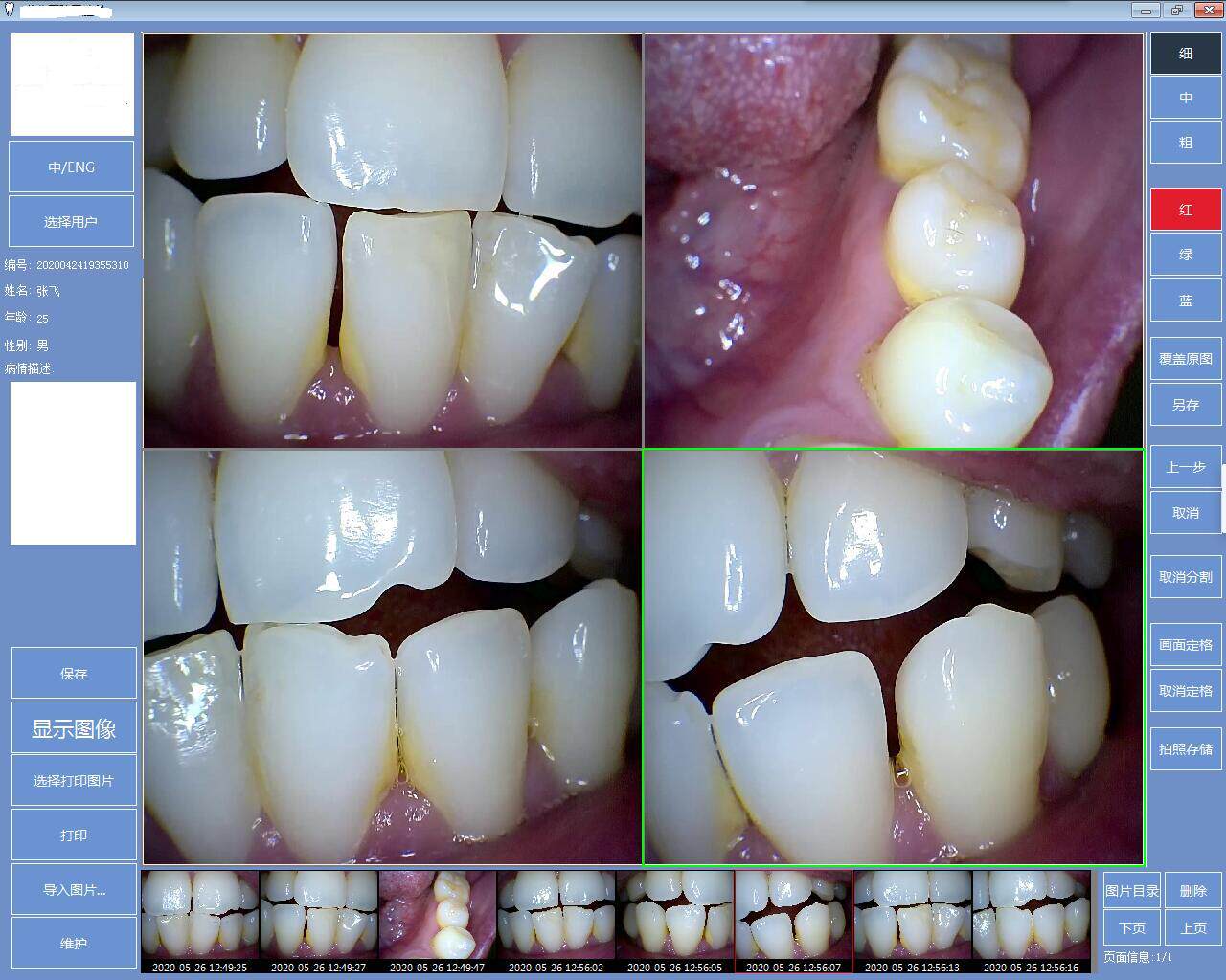 16세 매장 1080P USB 구강 내 카메라 컴퓨터 태블릿 안드로이드 APPLE 등 무료 소프트웨어 U 디스크