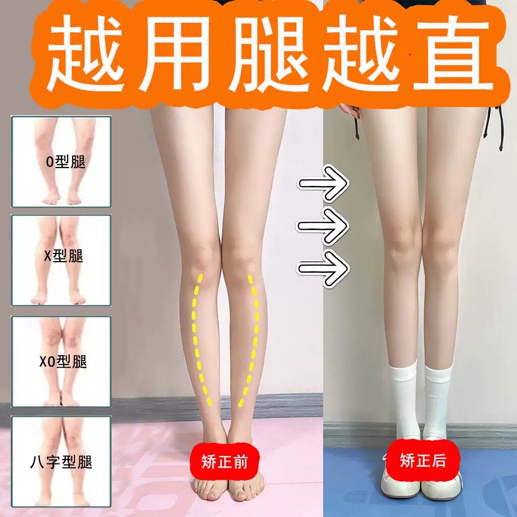 【屈臣优选推荐】o型x型小腿外翻腿矫正腿型直腿神器儿童成人通用