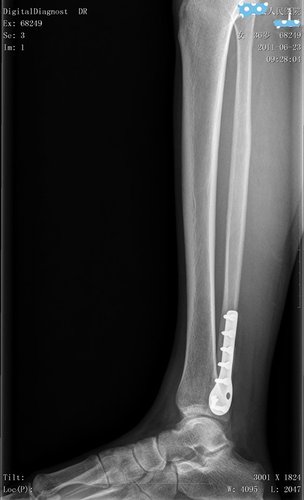 dicom数字软件图文报告打印