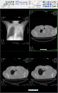 竖屏医学屏DR CT图文报告工作站软件图像接收刻盘DICOM打印