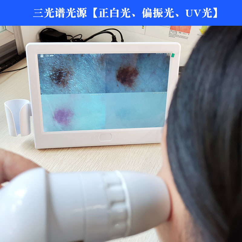 OSUSO充电一体机检测仪三光谱