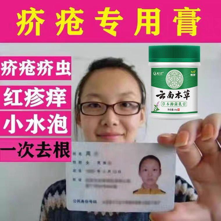 疥疮膏硫磺软膏外阴结节一扫光治芥虫阴虱介螨皮肤干燥云南疥苍膏