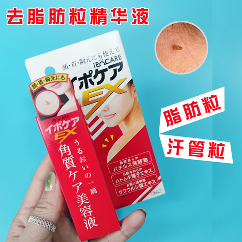 去颈部脂肪粒素材模板 去颈部脂肪粒图片下载 小麦优选