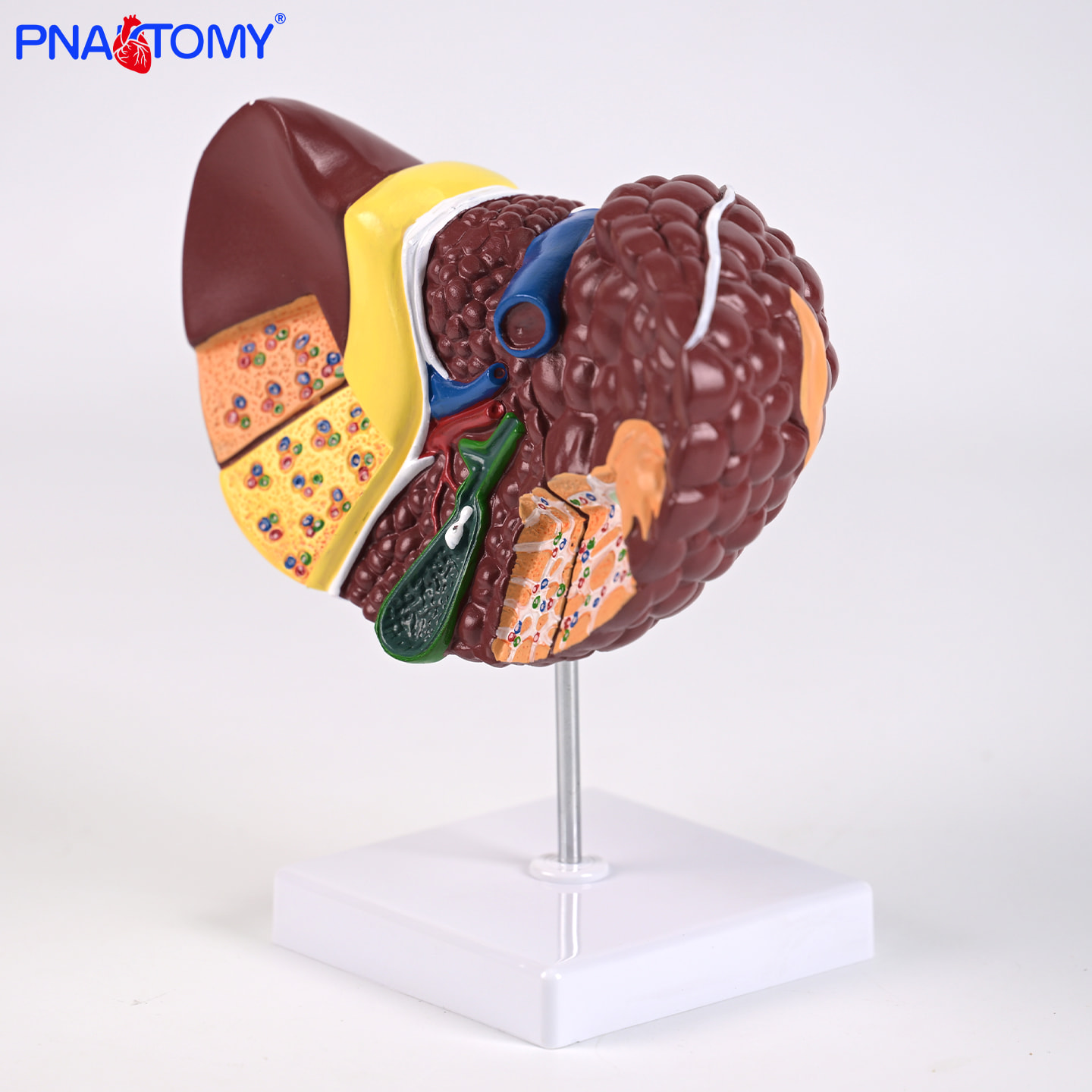 医用大病理肝解剖模型肝病变细节肿瘤硬化标注医学教学实训展道具
