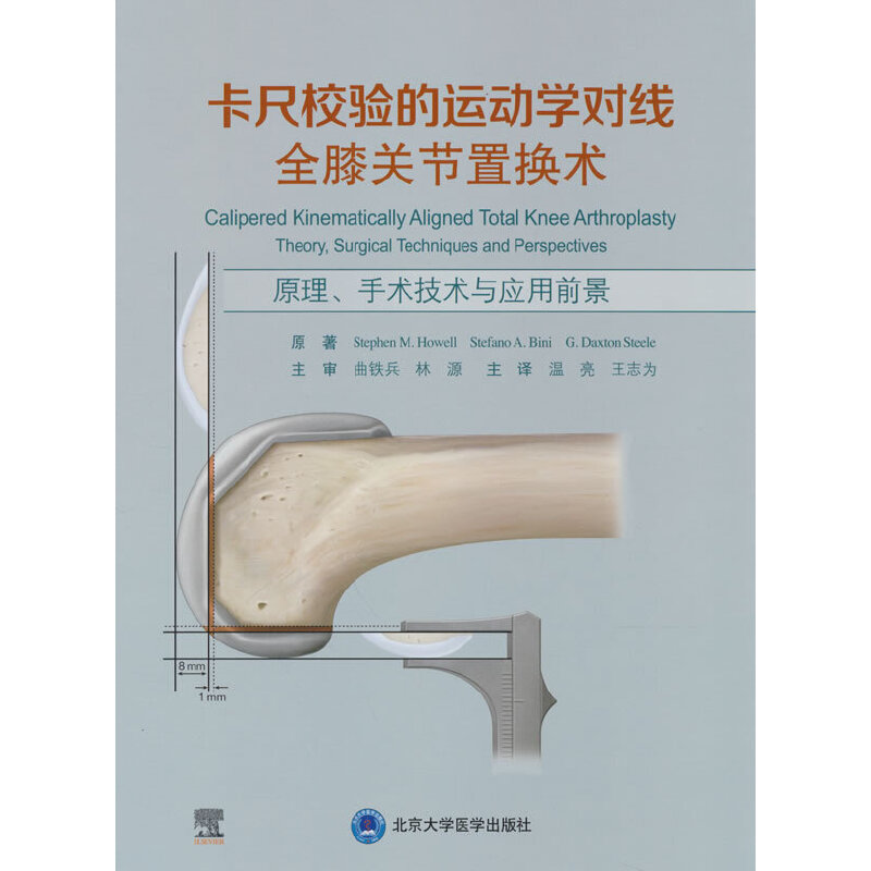 卡尺校验的运动学对线全膝关节置换术——原理、手术技术与应用前景