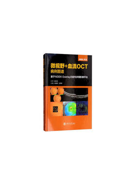 微视野+血流OCT病例图谱——基于NIDEK Overlay功能性多模影像平台