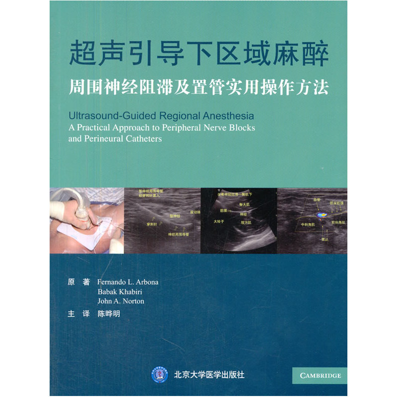 超声引导下区域麻醉——周围神经阻滞及置管实用操作方法(W)