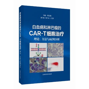 白血病和淋巴瘤的CAR-T细胞治疗:理论、方法与病例分析