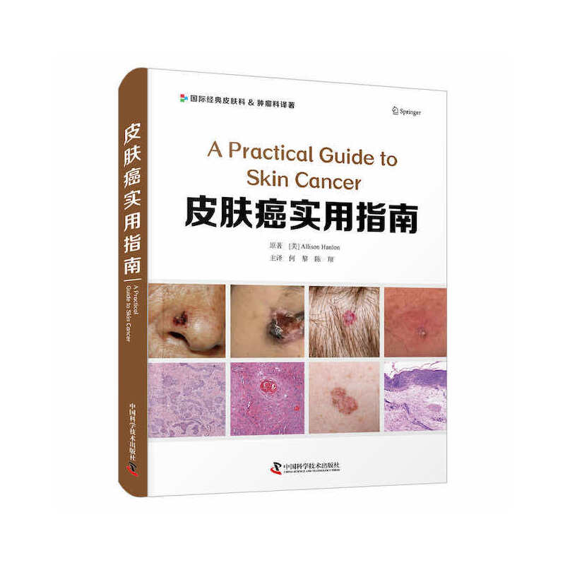 皮肤癌实用指南
