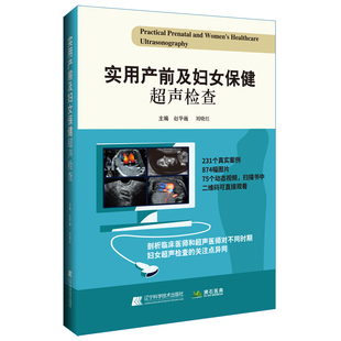 实用产前及妇女保健超声检查