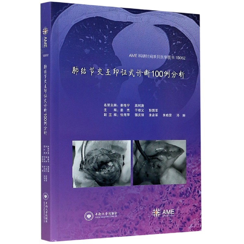 肺结节交互印证式诊断100例分析