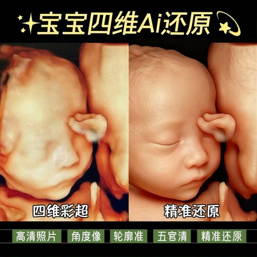 宝宝三四维ai照片彩超还原高清