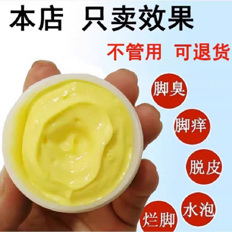 手上小水泡止痒草药抑菌鹅掌风汗泡疱真菌感 染手气湿痒疹专用膏