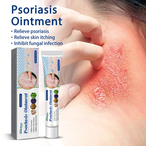 Skin itching cream for external use, causing itching