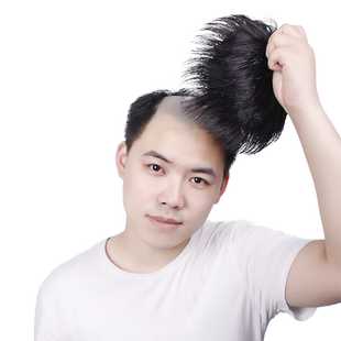 男士补发片假发套头顶补发前额秃顶补发垫接发翻盖假发真发男发块