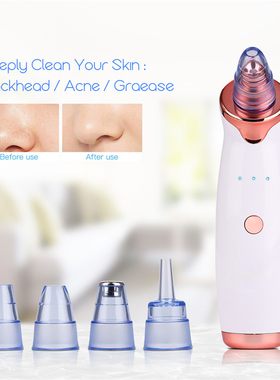 Microdermabrasion Blackhead Remover Vacuum Suction Face Pimp