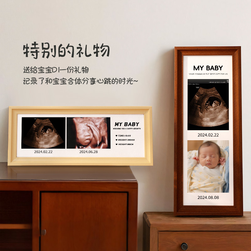 宝宝四维B超照片相框摆台定制孕期纪念相册打印怀孕婴儿出生礼物