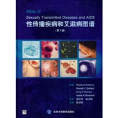 性传播疾病和艾滋病图谱