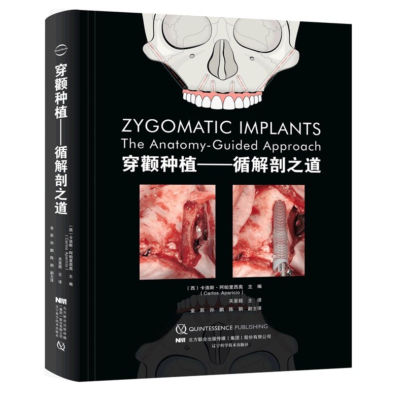 3预售正版全xin穿颧种植循解剖之道牙科口腔医学卡洛阿帕里西奥主编关呈超主译辽宁科学技术出版社9787559110985