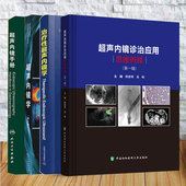 超声内镜手册 第一辑 超声内镜学 超声内镜诊治应用思维例释 治疗性超声内镜学 第3版 4本套