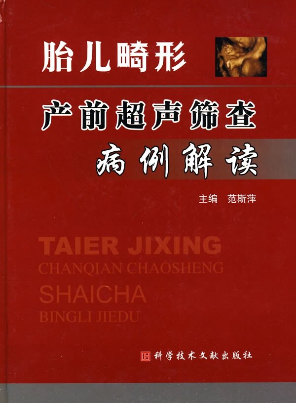 胎儿畸形产前超声筛查病例解读