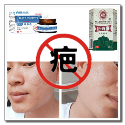祛除儿童增生性体质凹凸疤烧伤药液软化疙瘩去烟烫黑色素疤痕印膏